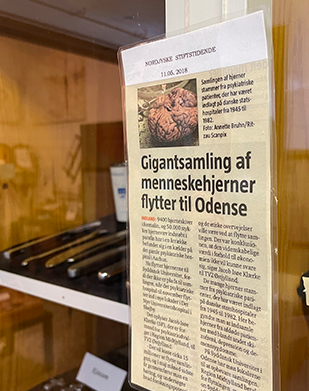 Et skab som indeholder instrumenter som blev brugt til at fjerne hjerner.